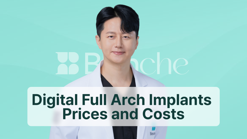 Digital Full Arch Implants Prices and Costs