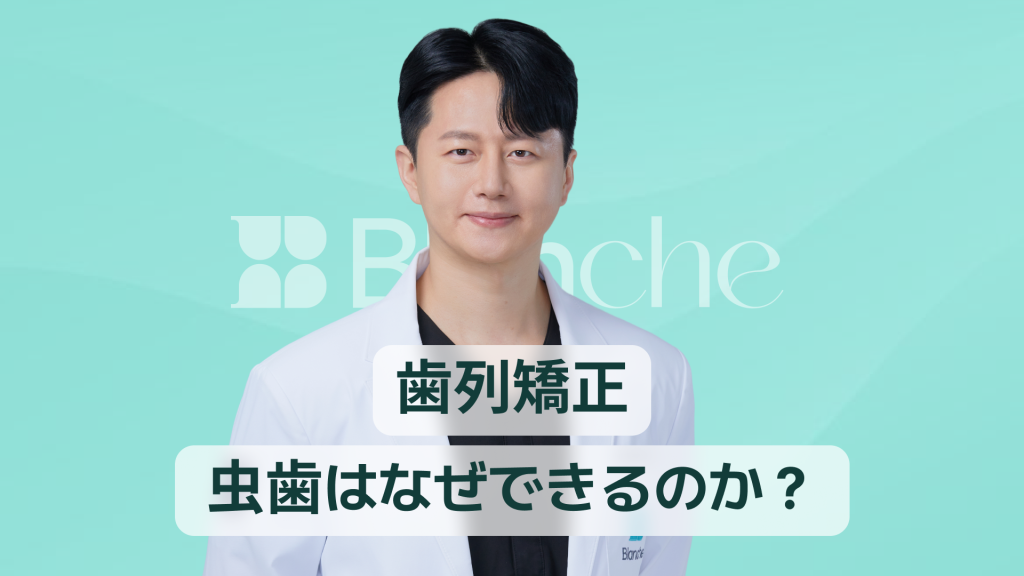 【韓国歯科】歯列矯正中の虫歯：なぜできる？どう予防する？矯正段階別完全管理ガイド