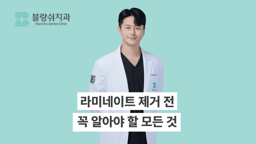 라미네이트 제거 전 꼭 알아야 할 모든 것