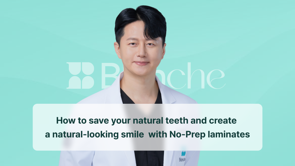 How to save your natural teeth and create a natural-looking smile with No-Prep laminates