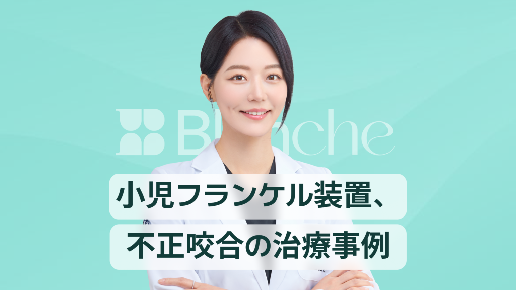 【韓国歯科】子どもの受け口や不正咬合の矯正、フランケル装置の治療症例