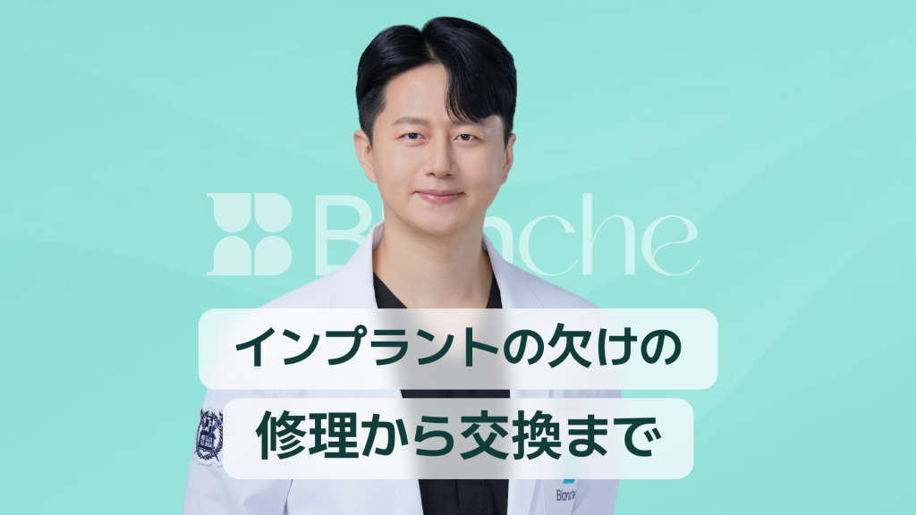 【韓国歯科】インプラントの破損費用、修理から再施術まで一度にチェック