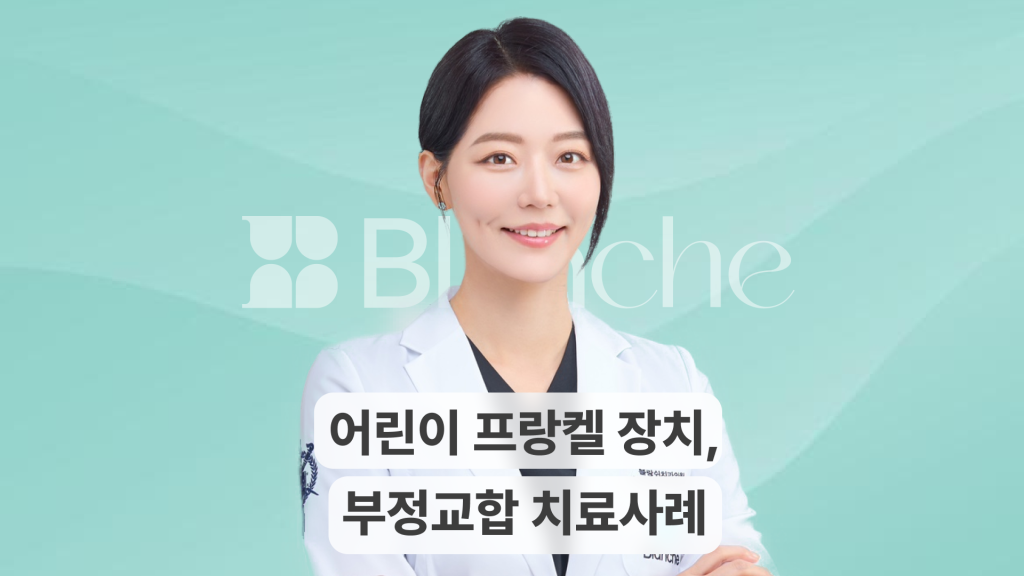 어린이 주걱턱과 부정교합 교정, 프랑켈 장치 치료 사례