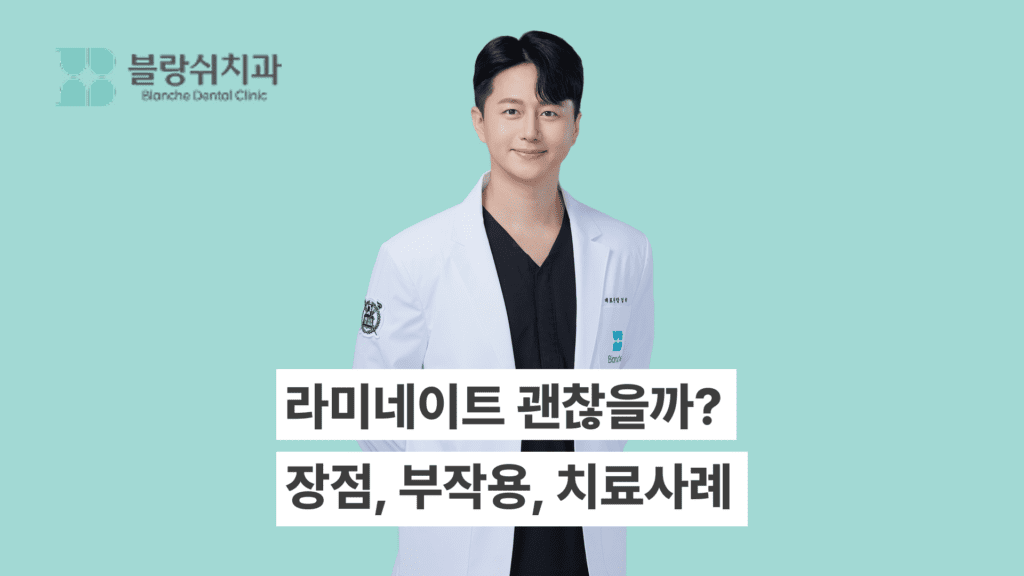 라미네이트 장점과 부작용, 치료사례