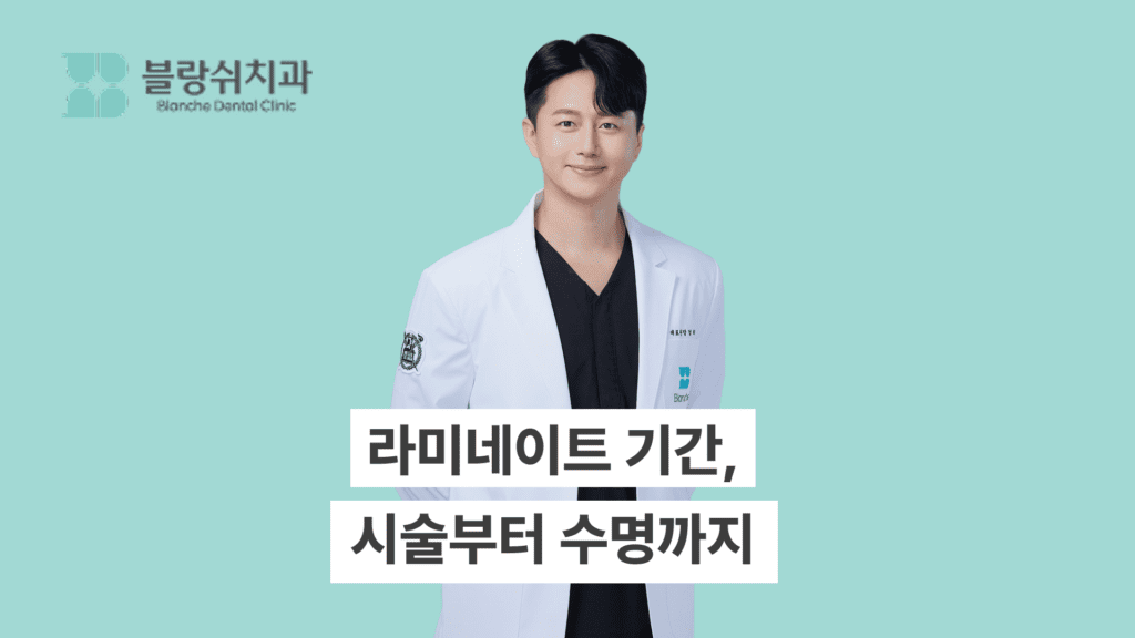 라미네이트 기간 시술부터 수명까지