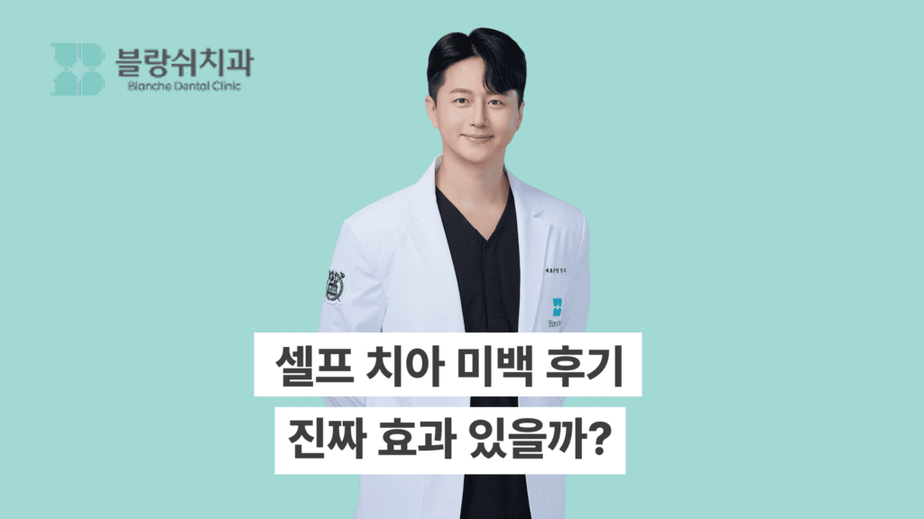 셀프 치아 미백 후기