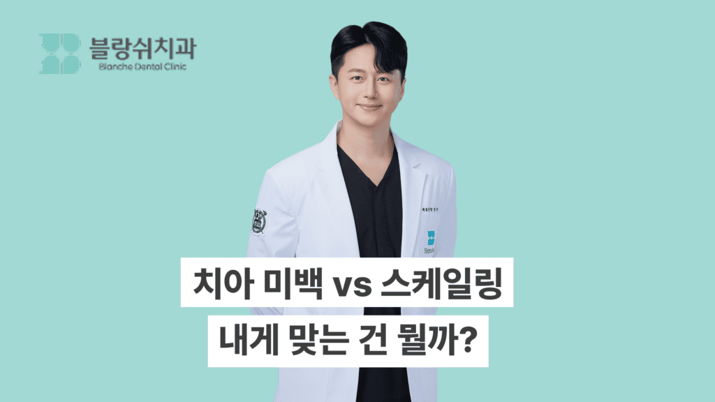 치아 미백 스케일링 차이