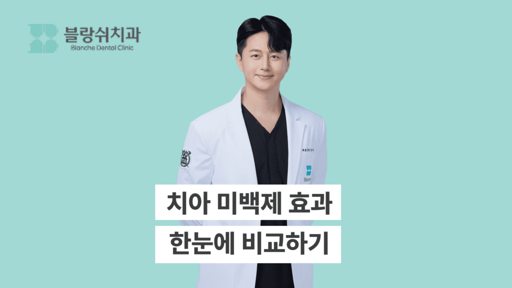 치아 미백제 효과 한눈에 비교하기