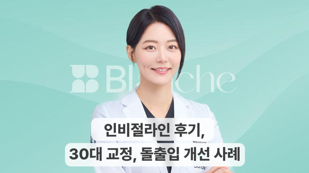 인비절라인 후기, 30대 교정 돌출입 개선 사례