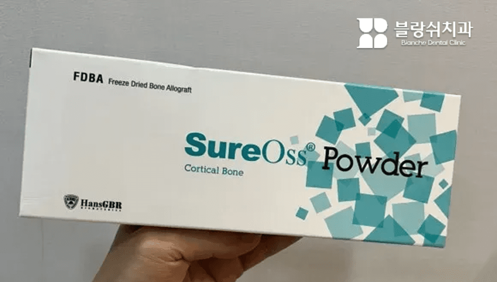3. FDBA 동종골 뼈이식재 슈어오스 파우더 제품 사진