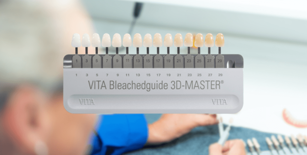 3.VITA Bleachedguide를 사용해 치아 색상 단계를 비교하는 쉐이드 가이드 사진