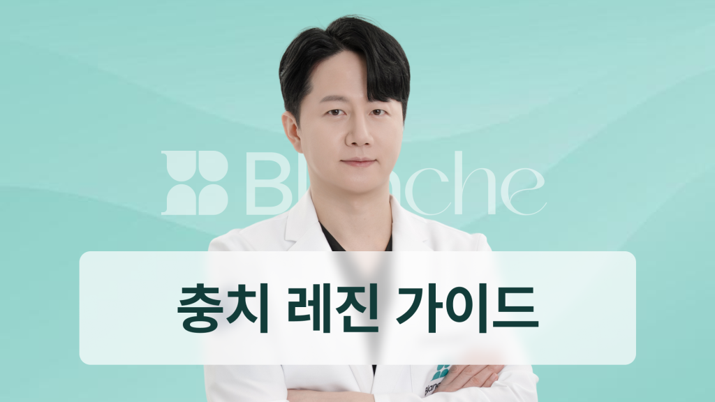 충치 레진 치료 완벽가이드 초기충치부터 비용까지 한눈에 끝내는 치과정보