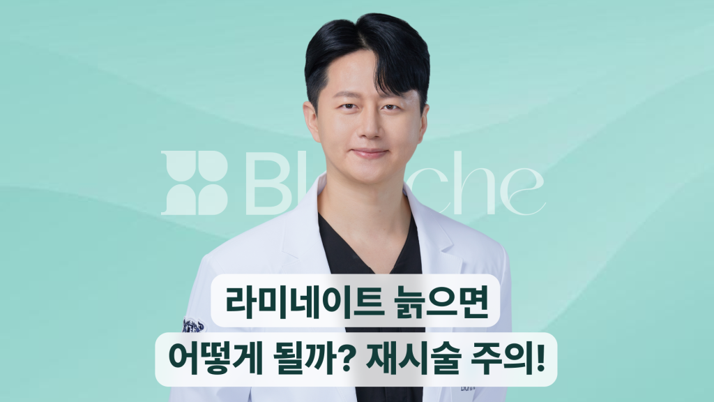 라미네이트 늙으면 어떻게 될까? 주요 변화와 재시술 주의점