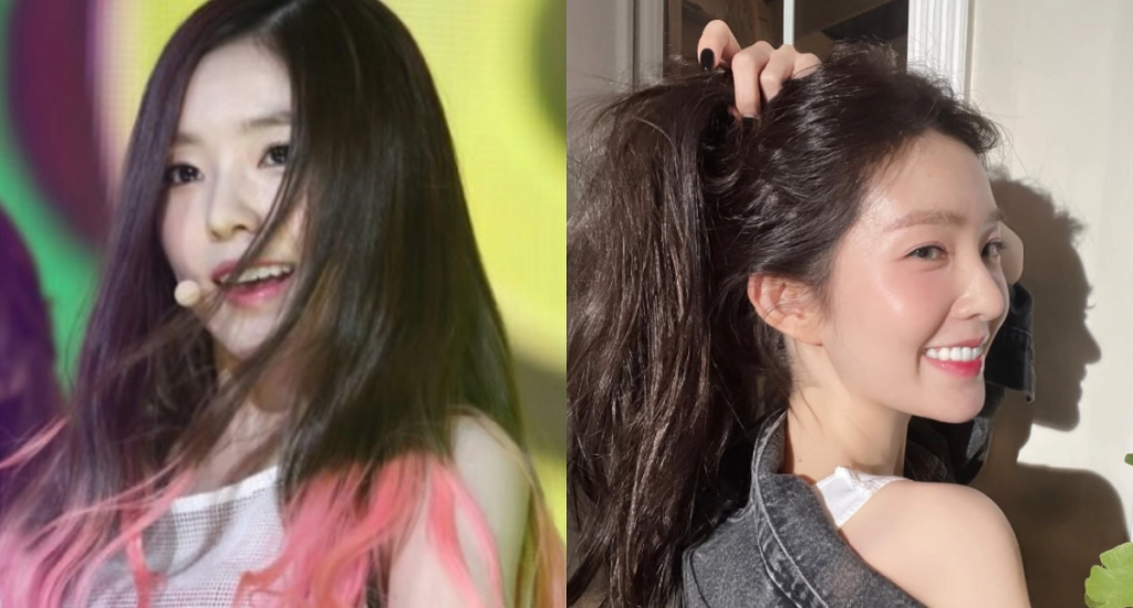 라미네이트 시술을 통해 더욱 정교하고 하얗게 변한 레드벨벳 아이린