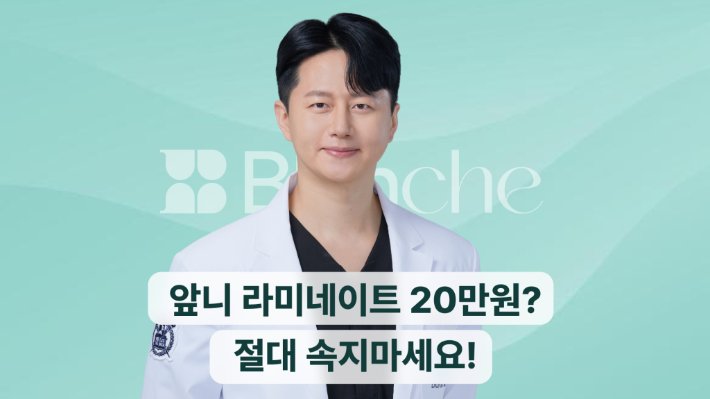 앞니라미네이트가격, 개당 20만원? 속지 마세요! 적정 비용, 부작용, 후기까지