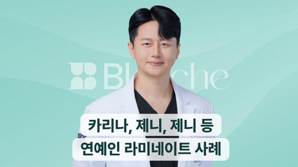 카리나, 제니, 박보검 등 연예인 라미네이트 사례