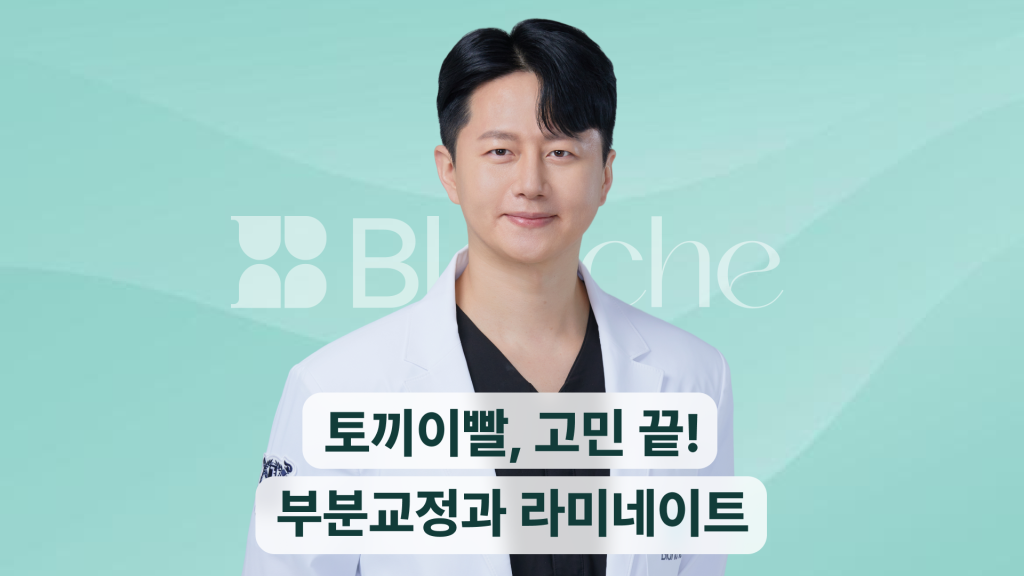 토끼이빨, 고민 끝! 부분교정부터 라미네이트까지