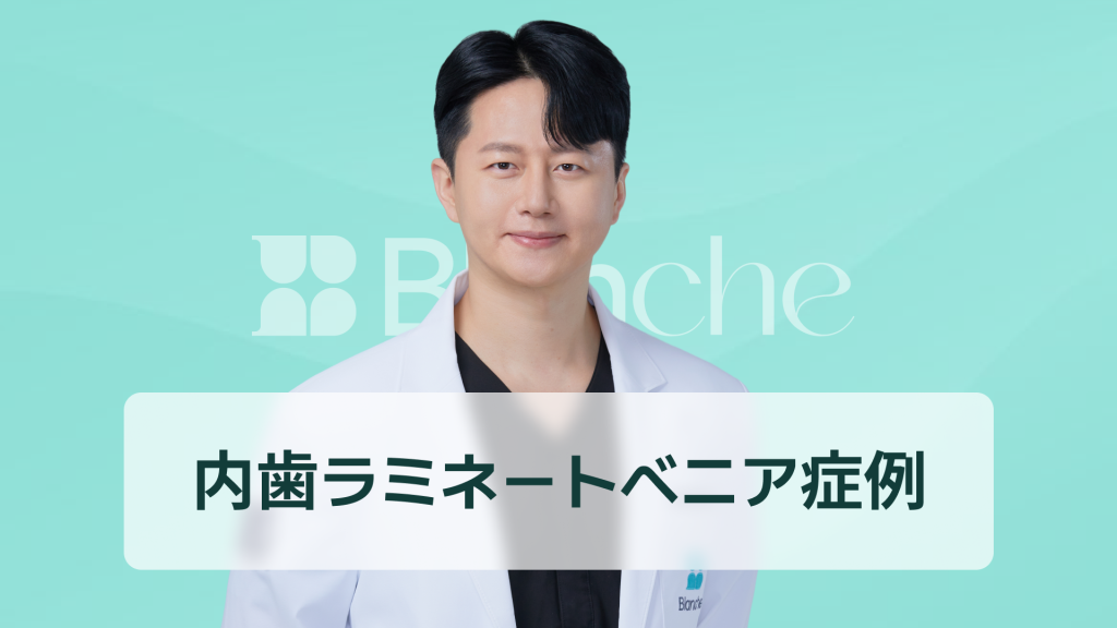 【韓国歯科】出っ歯とは何でしょうか？出っ歯ラミネート事例