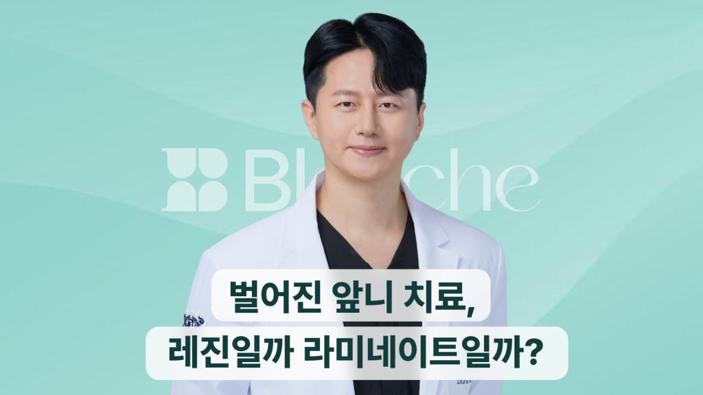 벌어진 앞니 치료, 레진일까 라미네이트일까?