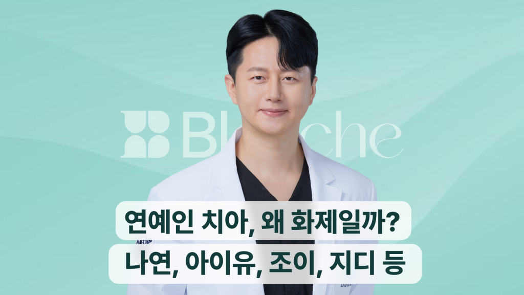 연예인 라미네이트 왜 화제일까? 나연, 아이유, 조이, 지디 등