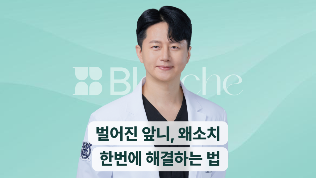 벌어진 앞니, 왜소치 한번에 해결하는 법