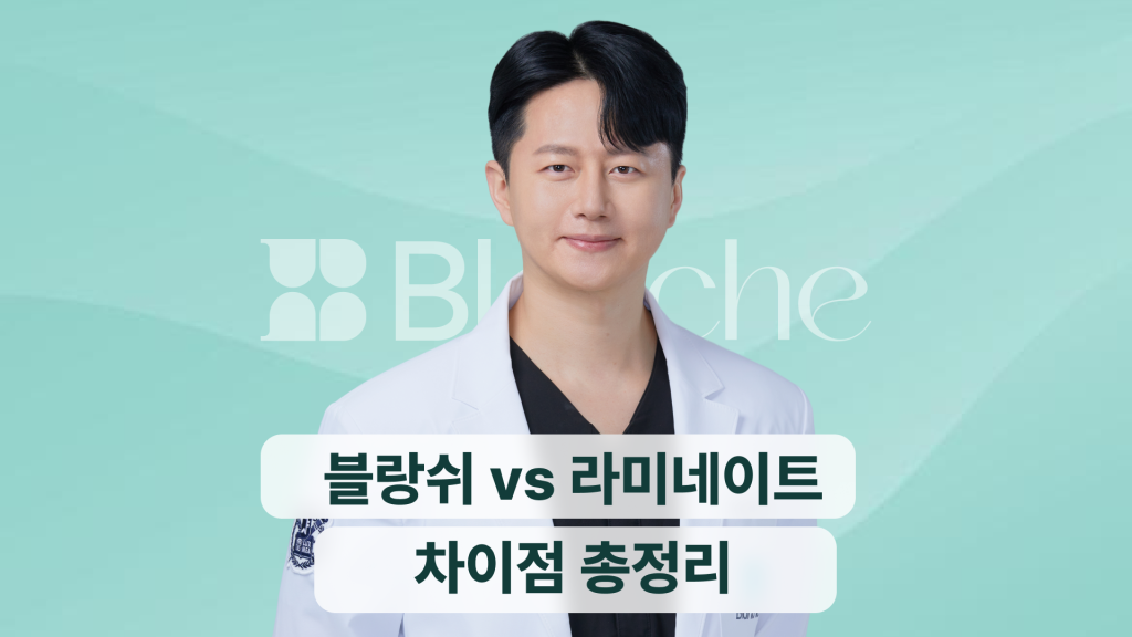 블랑쉬 vs 라미네이트 차이점 총정리