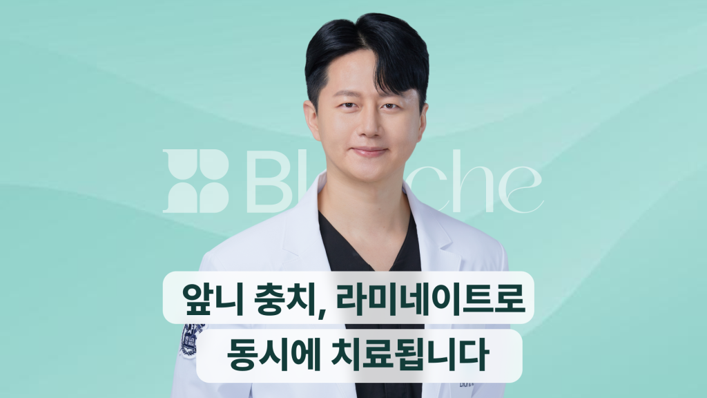 앞니 충치, 라미네이트로 동시에 치료됩니다