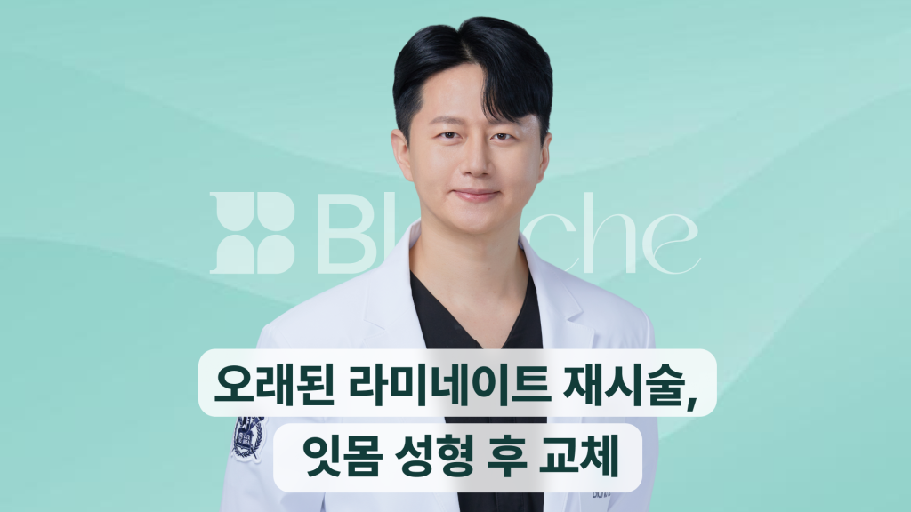 오래된-라미네이트-재시술-잇몸-성형-후-교체