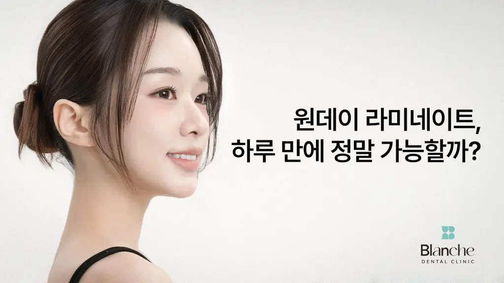 원데이 라미네이트, 하루 만에 가능할까?