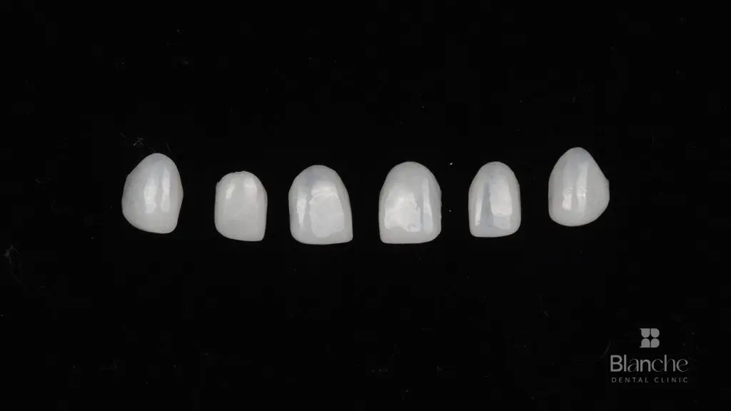 How many teeth do you actually need?