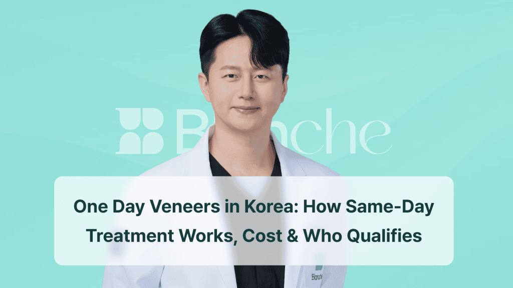 Same-Day Veneers