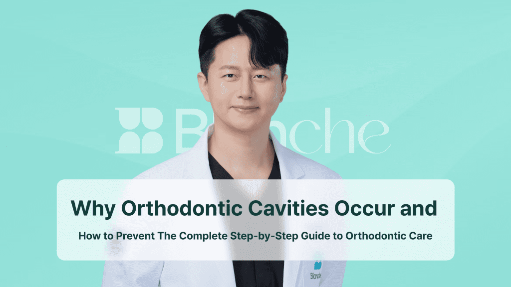 Why Orthodontic Cavities Occur and How to Prevent The Complete Step-by-Step Guide to Orthodontic Care