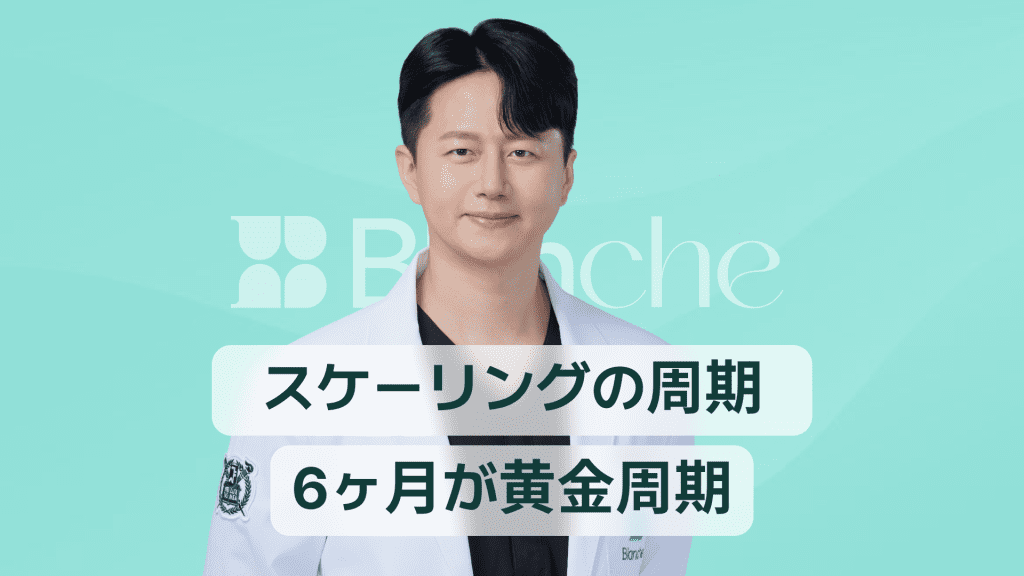 【韓国歯科】歯石除去（スケーリング）の周期、なぜ6ヶ月が黄金基準なのか？歯科専門医が解説します。