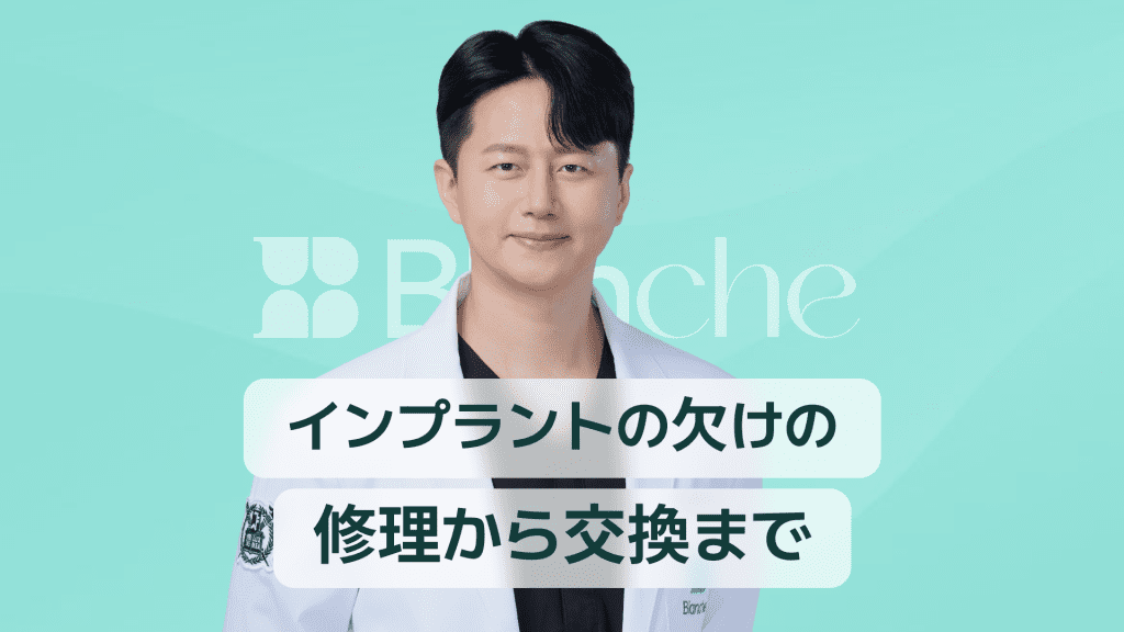 【韓国歯科】インプラントの破損費用、修理から再施術まで一度にチェック