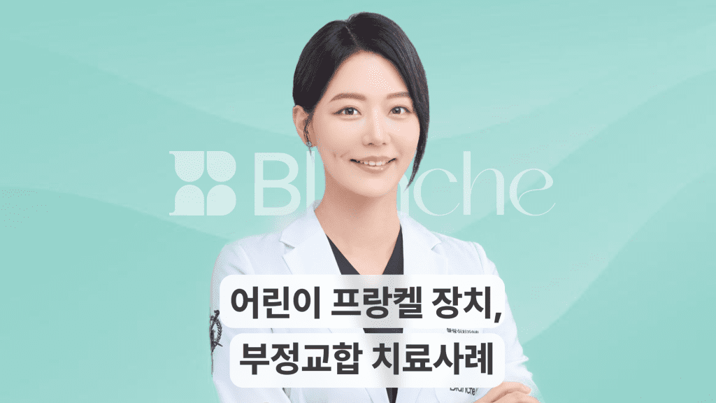 어린이 주걱턱과 부정교합 교정, 프랑켈 장치 치료 사례