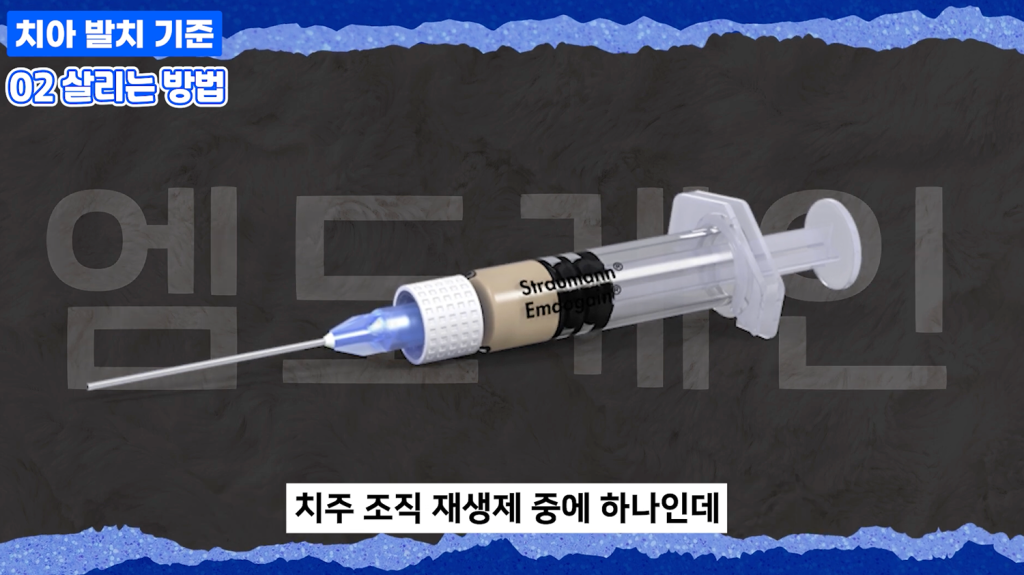 1.치주 조직 재생을 위해 사용하는 엠도게인 주사기 형태의 재생 유도 물질 이미지