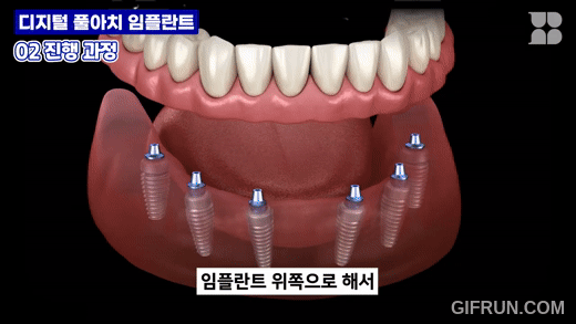 1. 정밀 진단 · 3D 분석