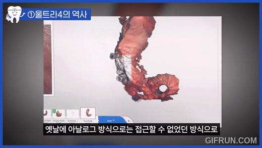 2. 디지털 수술 계획 · 가상 시뮬레이션