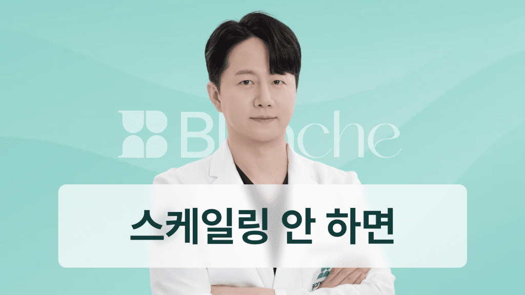 스케일링 안하는 사람에게 나타나는 충격적 변화 평생 방치하면 치아에 생기는 일
