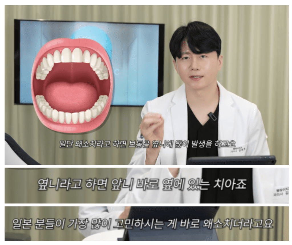왜소치, 앞니에 대한 고민