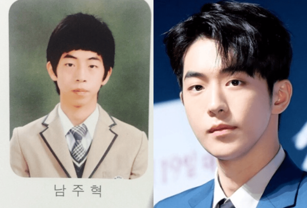 남주혁 돌출입 교정