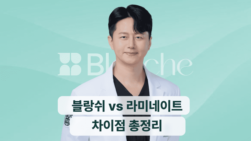 블랑쉬 vs 라미네이트 차이점 총정리