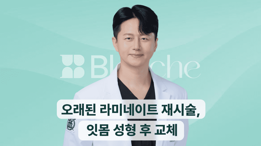 오래된-라미네이트-재시술-잇몸-성형-후-교체