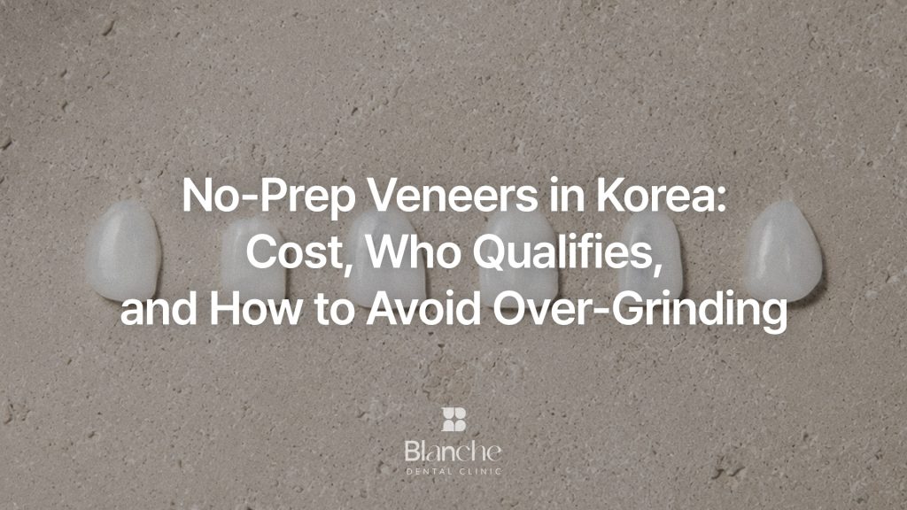 Porcelain vs Composite Veneers in Korea: Cost, Lifespan, and How to Choose