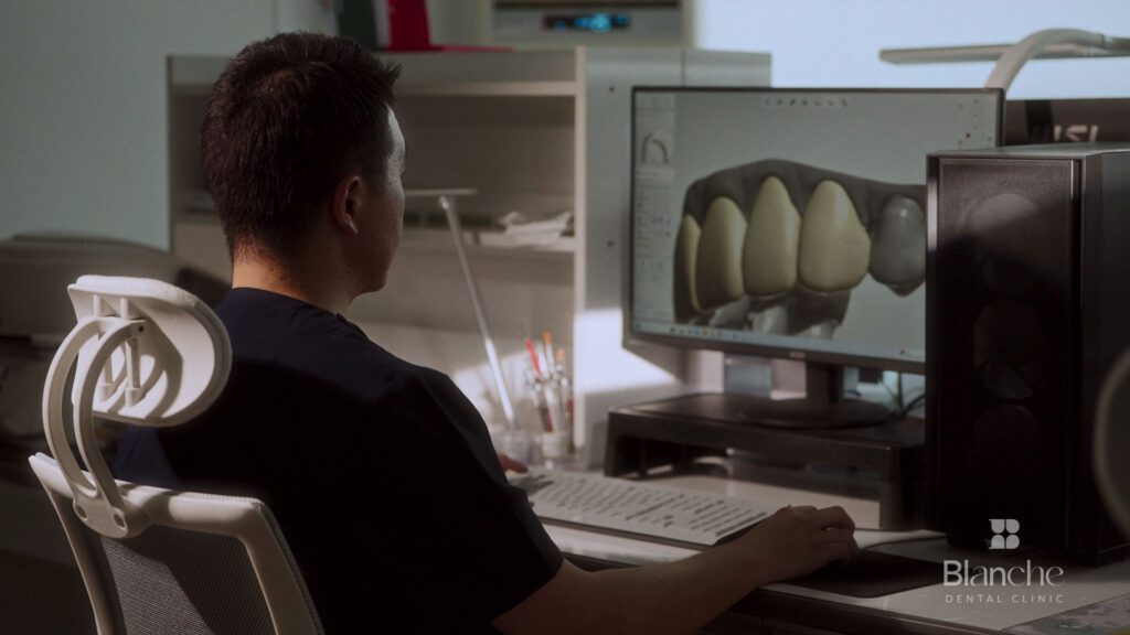 블랑쉬랩 첨단 3D 기공방식