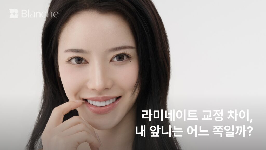 라미네이트 교정 차이 판단 기준 5가지