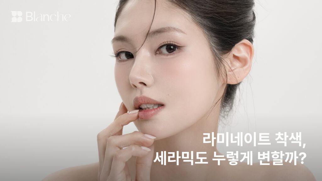 라미네이트 착색, 세라믹도 누렇게 변할까? 실제로 물드는 자리 4곳