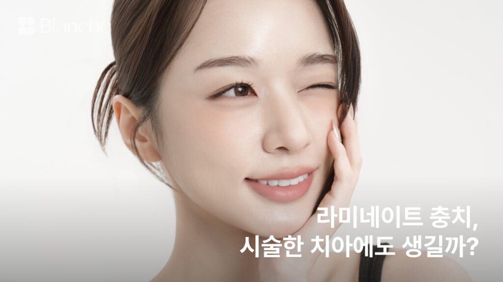 라미네이트 충치, 시술한 치아에도 생길까? 위험 부위와 발견·치료 기준