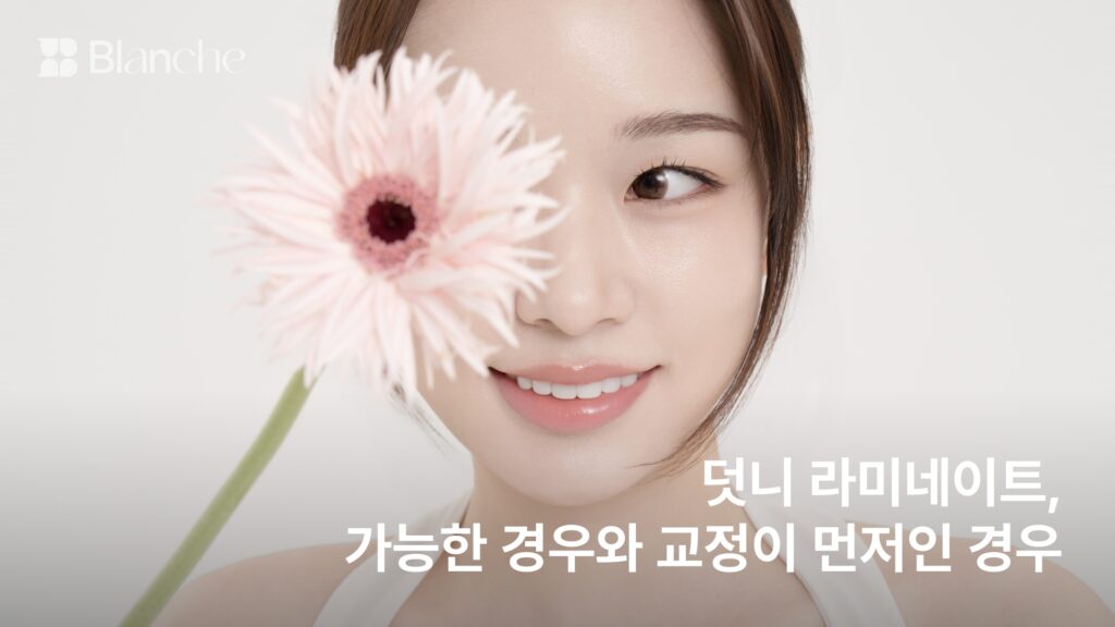 덧니 라미네이트, 가능한 경우와 교정이 먼저인 경우