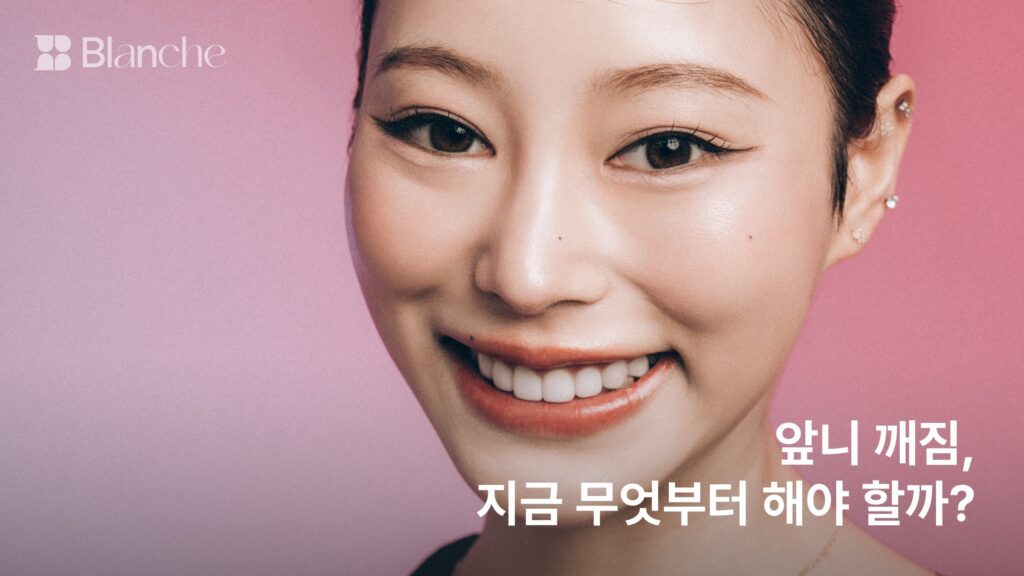 앞니 깨짐, 지금 무엇부터 해야 할까? 레진·라미네이트·크라운이 갈리는 기준